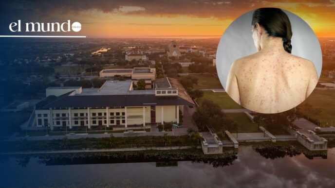 Measles outbreak in Florida: Ave Maria University confirms 60 cases